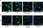 ZO-1 Antibody in Immunocytochemistry (ICC/IF)