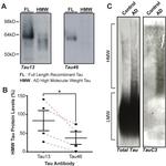 Tau Antibody in Western Blot (WB)