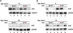 AFP Antibody in Western Blot (WB)