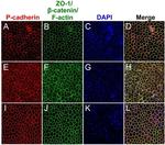 ZO-1 Antibody in Immunohistochemistry (IHC)