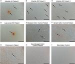 alpha Synuclein Antibody in Immunohistochemistry (IHC)