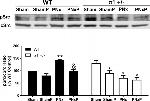 Phospho-SRC (Tyr419) Antibody in Western Blot (WB)