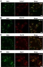 RAB11A Antibody in Immunocytochemistry (ICC/IF)