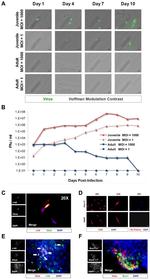 GFP Antibody in Immunocytochemistry (ICC/IF)