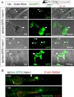 GFP Antibody in Immunocytochemistry (ICC/IF)