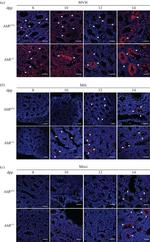 PIWIL1 Antibody in Immunohistochemistry (Paraffin) (IHC (P))