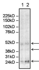 Sialosyl-Tn Antigen Monoclonal Antibody (STn 219)