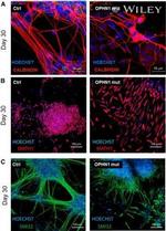 ATOH1 Antibody in Immunohistochemistry (IHC)