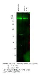 SKOR1 Polyclonal Antibody