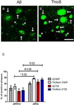 beta Amyloid Polyclonal Antibody