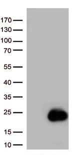BIRC5/Survivin Antibody in Western Blot (WB)