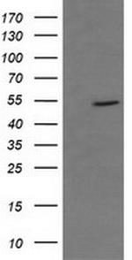 CD36 Antibody in Western Blot (WB)