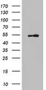 KRT7 Antibody in Western Blot (WB)