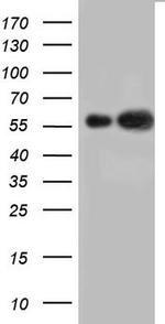 KRT7 Antibody in Western Blot (WB)