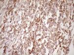 ERBB3 Antibody in Immunohistochemistry (Paraffin) (IHC (P))