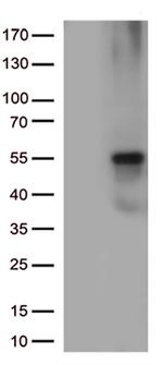 KRT8 Antibody in Western Blot (WB)