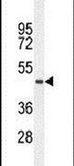 TMEM229A Antibody in Western Blot (WB)