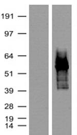 tdTomato Antibody in Western Blot (WB)