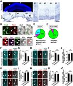 Ki-67 Antibody in Immunohistochemistry, Immunocytochemistry (IHC, ICC/IF)