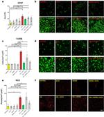 GFAP Antibody in Immunohistochemistry, Immunocytochemistry (IHC, ICC/IF)