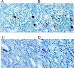 IL-8 (CXCL8) Antibody in Immunohistochemistry (IHC)