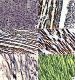 Adenovirus Type 2/5 Antibody in Immunohistochemistry (IHC)