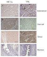 VHL Antibody in Immunohistochemistry (Paraffin) (IHC (P))