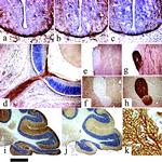 Cannabinoid Receptor 1 Antibody in Immunohistochemistry (IHC)