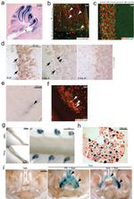 Estrogen Receptor alpha Antibody in Immunohistochemistry (IHC)