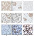 p130Cas Antibody in Immunohistochemistry (IHC)