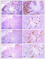 CA125 Antibody in Immunohistochemistry (IHC)