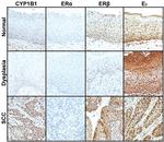 Estrogen Receptor alpha Antibody in Immunohistochemistry (IHC)