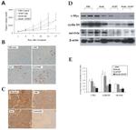 Cyclin D1 Antibody in Immunohistochemistry (IHC)