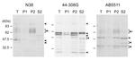 OPRM1 Antibody in Western Blot (WB)