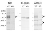 OPRM1 Antibody in Western Blot (WB)