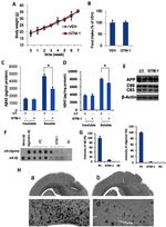 beta Amyloid Antibody in ELISA (ELISA)