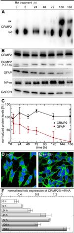 GFAP Antibody in Western Blot (WB)