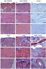 Desmoglein 2 Antibody in Immunohistochemistry (IHC)