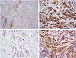 MMP9 Antibody in Immunohistochemistry (IHC)