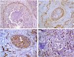 MMP9 Antibody in Immunohistochemistry (IHC)