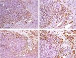 MMP9 Antibody in Immunohistochemistry (IHC)