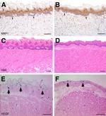 Neuropilin 1 Antibody in Immunohistochemistry (IHC)