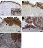 Neuropilin 1 Antibody in Immunohistochemistry (IHC)