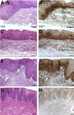 Neuropilin 1 Antibody in Immunohistochemistry (IHC)