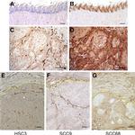 Neuropilin 1 Antibody in Immunohistochemistry (IHC)