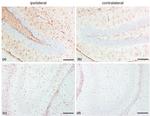 GFAP Antibody in Immunohistochemistry (IHC)