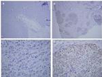 Estrogen Receptor beta Antibody in Immunohistochemistry, Immunohistochemistry (Paraffin) (IHC, IHC (P))