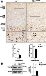 VGLUT2 Antibody in Immunohistochemistry (IHC)