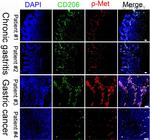 CD206 (MMR) Antibody in Immunohistochemistry, Immunocytochemistry (IHC, ICC/IF)