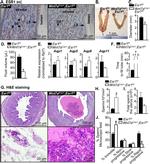 Estrogen Receptor alpha Antibody in Immunohistochemistry (IHC)